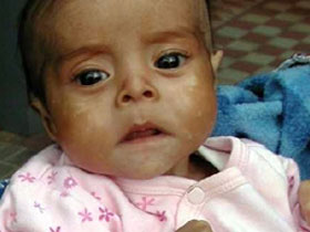 Guatemala care work volunteer projects
